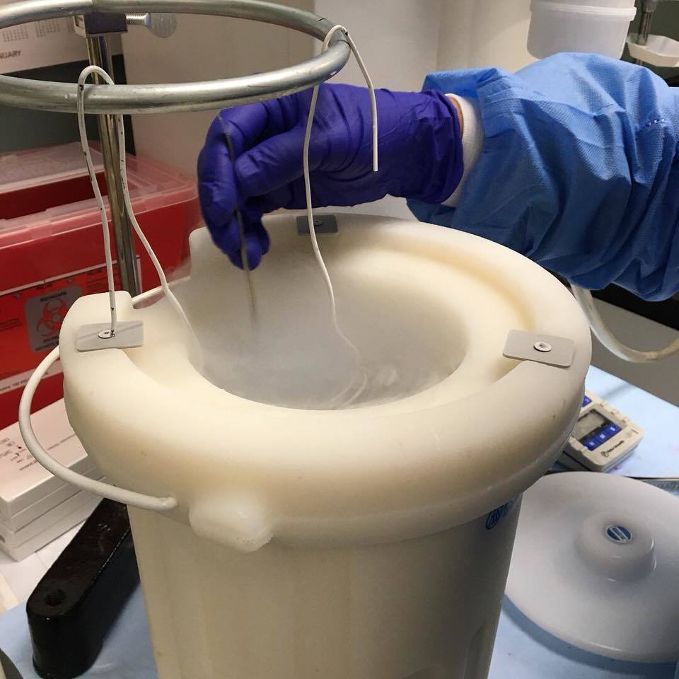 muscle biopsy being processed