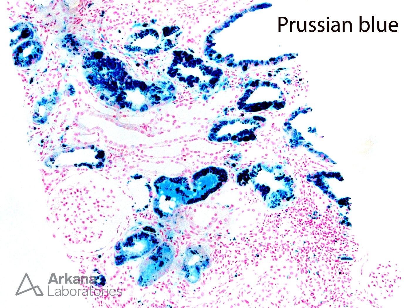 Prussian blue stain of renal cortex