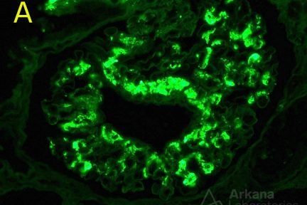 paraffin immunofluorescence