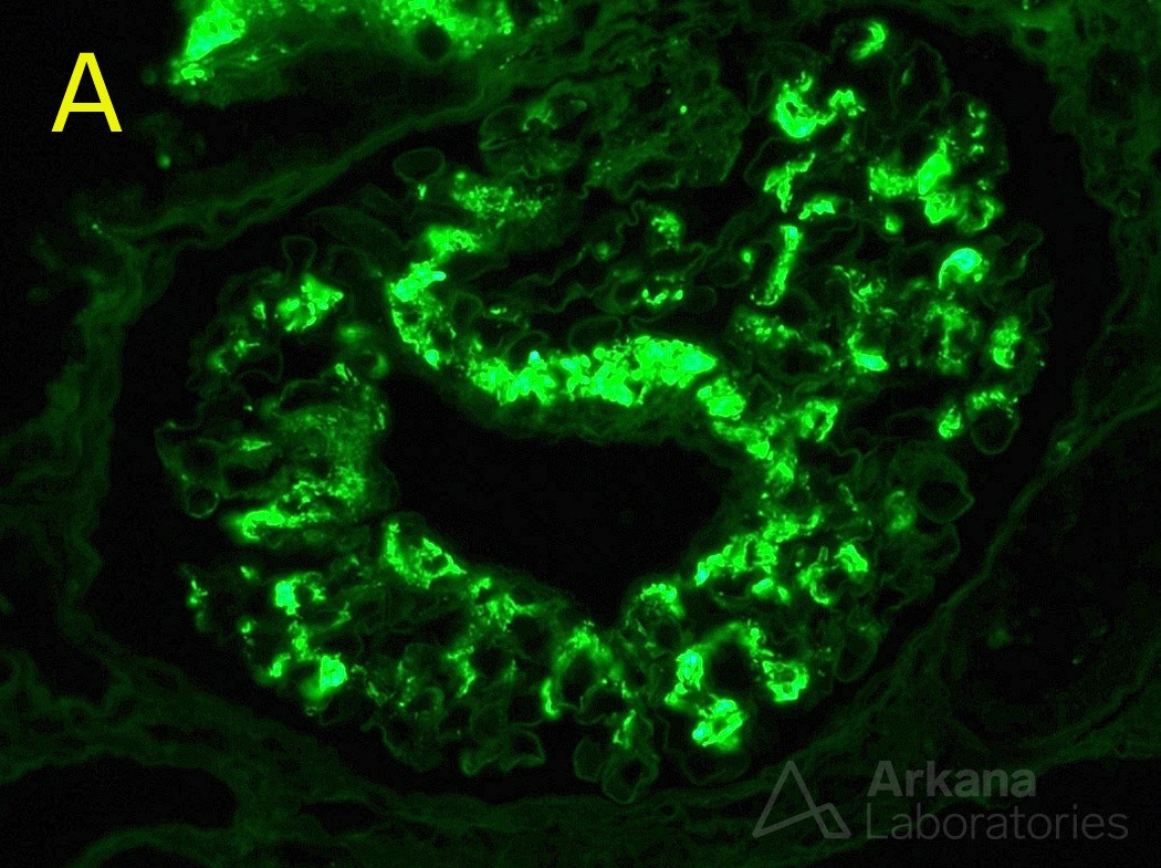 paraffin immunofluorescence