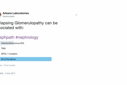 Collapsing glomerulopathy