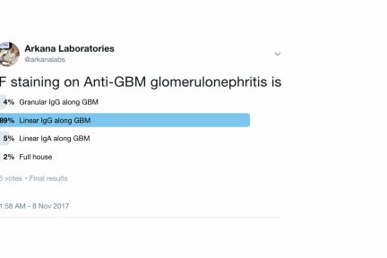 Anti-GBM Glomerulonephritis