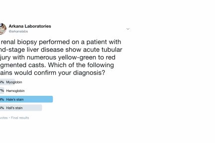 Hall's stain, bile casts