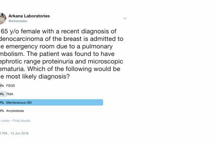 MGN Associated Malignancy