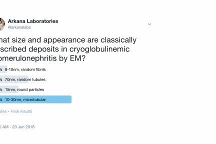 cryoglobulinemic GN’s