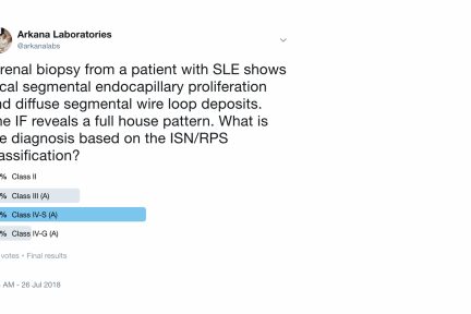 Class IV Lupus Nephritis