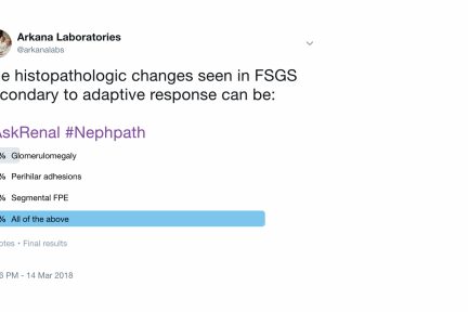 FSGS Secondary