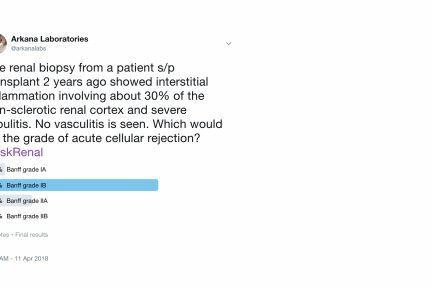 Acute T-Cell Mediated Rejection